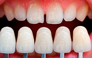 Микропротезирование