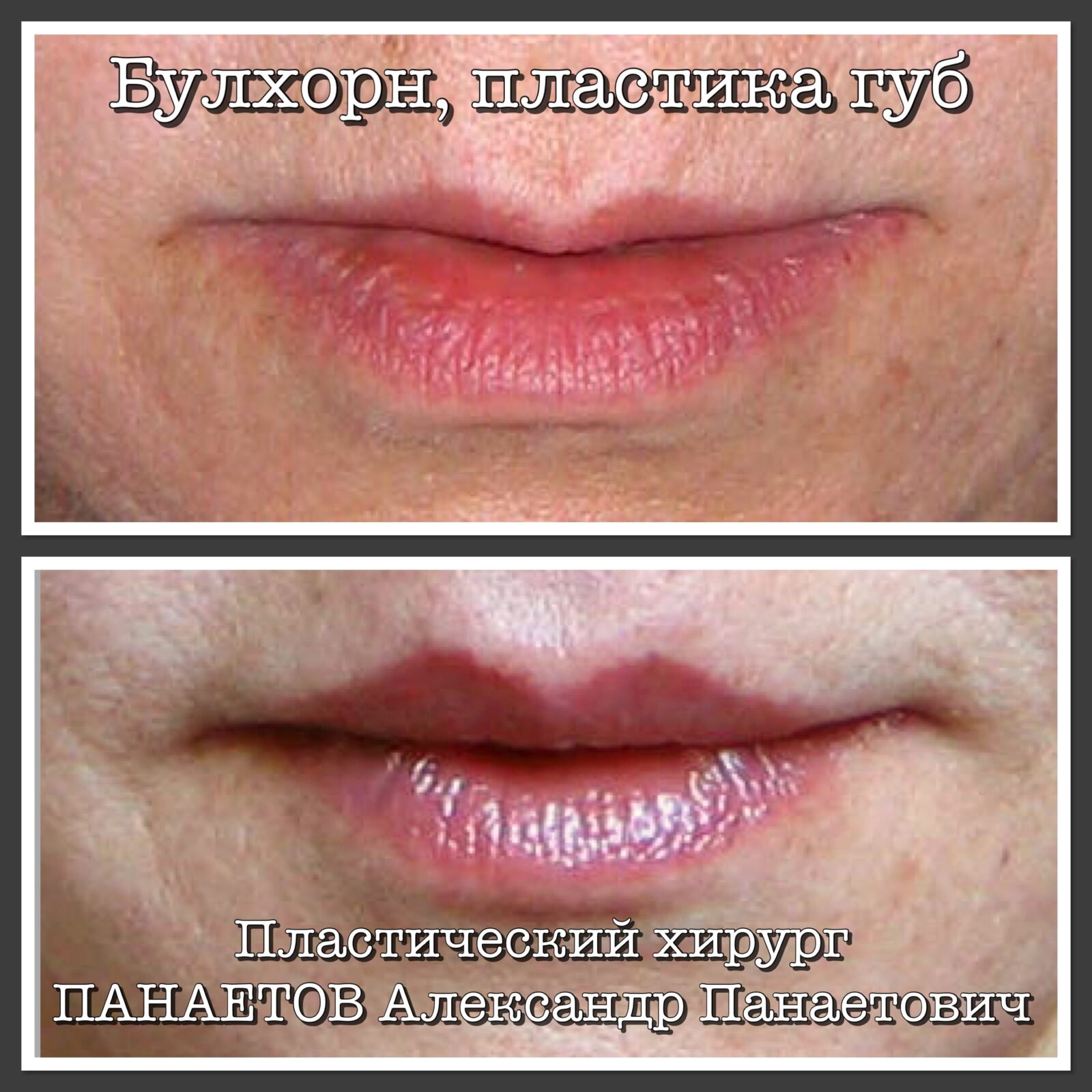 IMG_2130-08-10-18-05-37