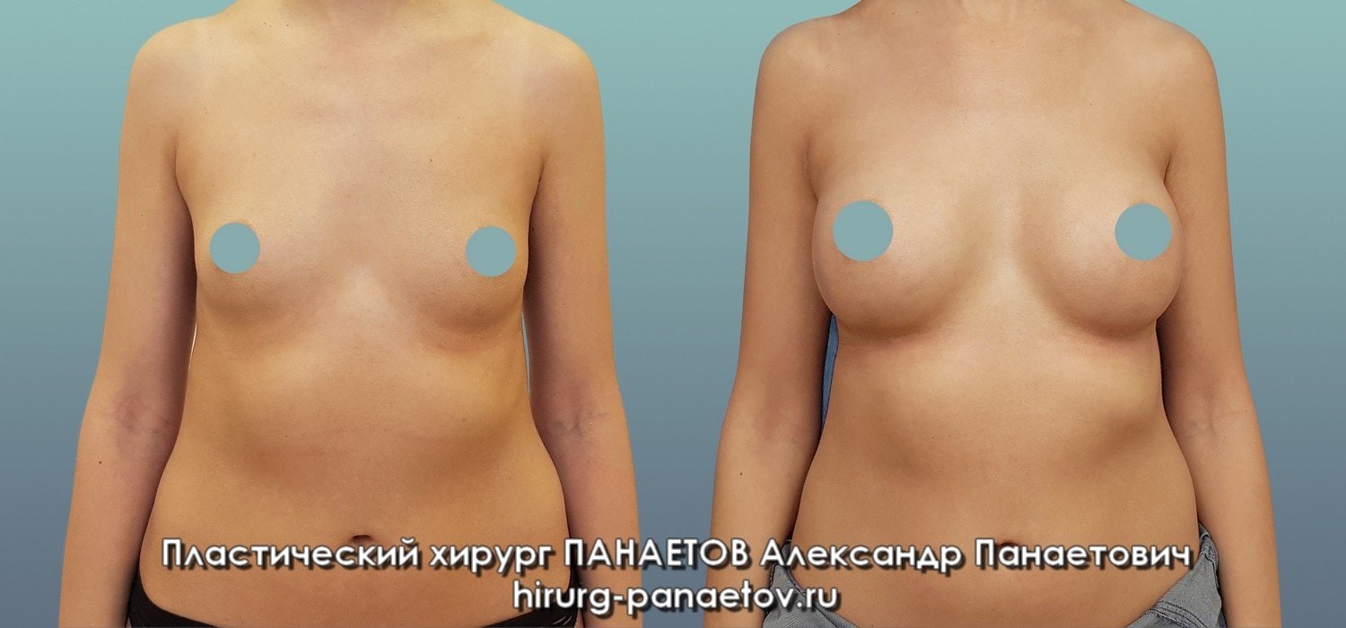 PAN-23-june-GR-fas-1zzz