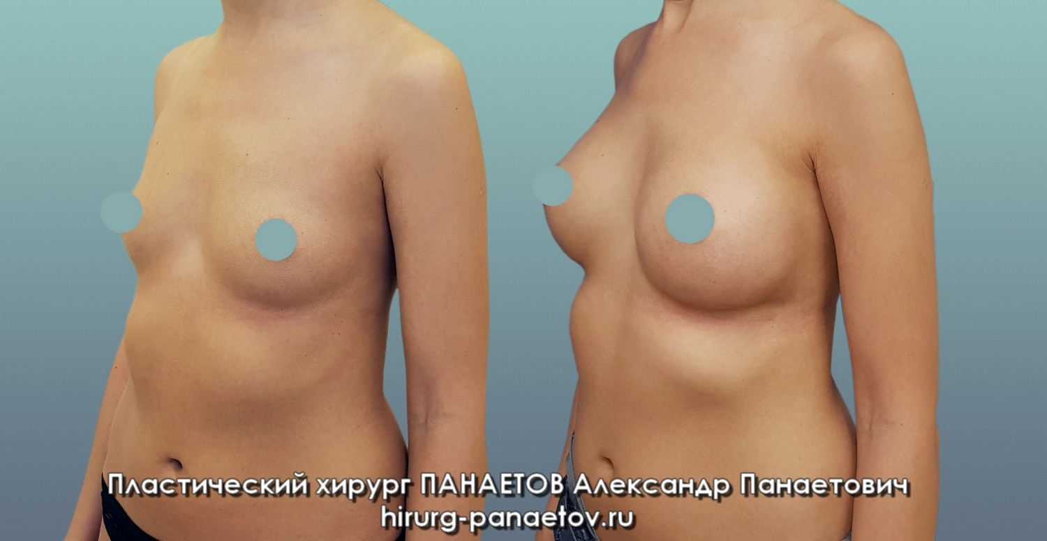 PAN-23-june-GR-trichetv-2zz