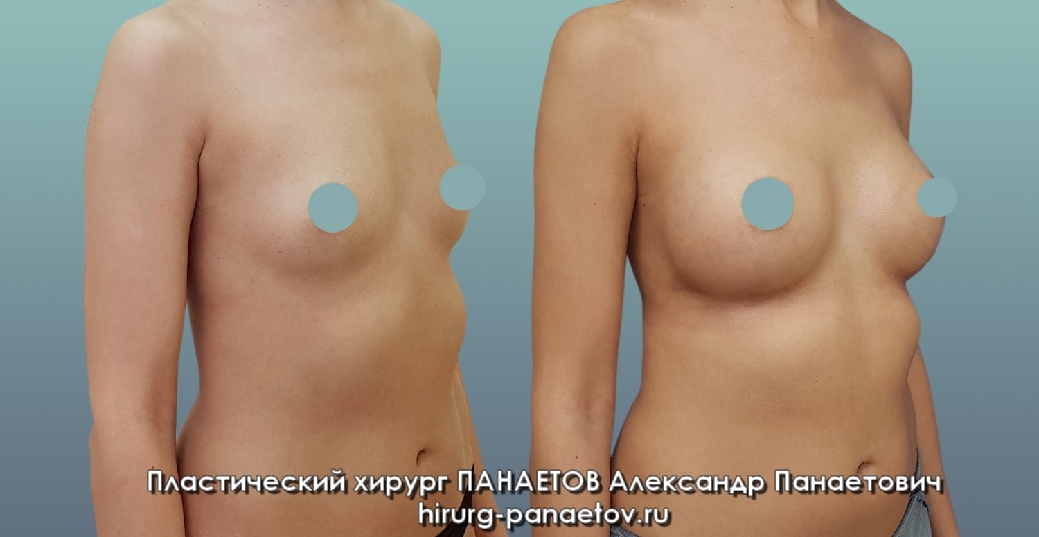 PAN-23-june-GR-trichetv-lev-3