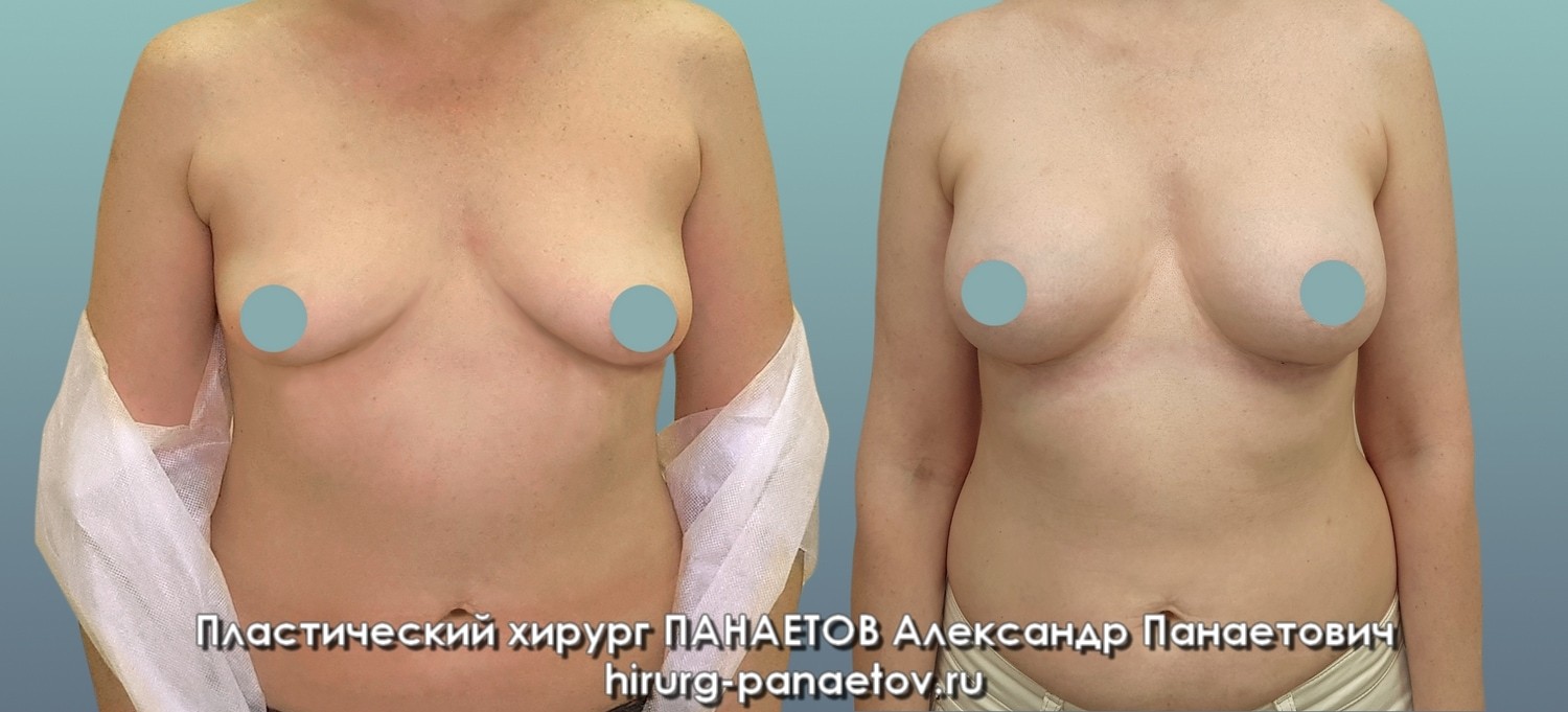 PAN-26-june-GR-fas-1