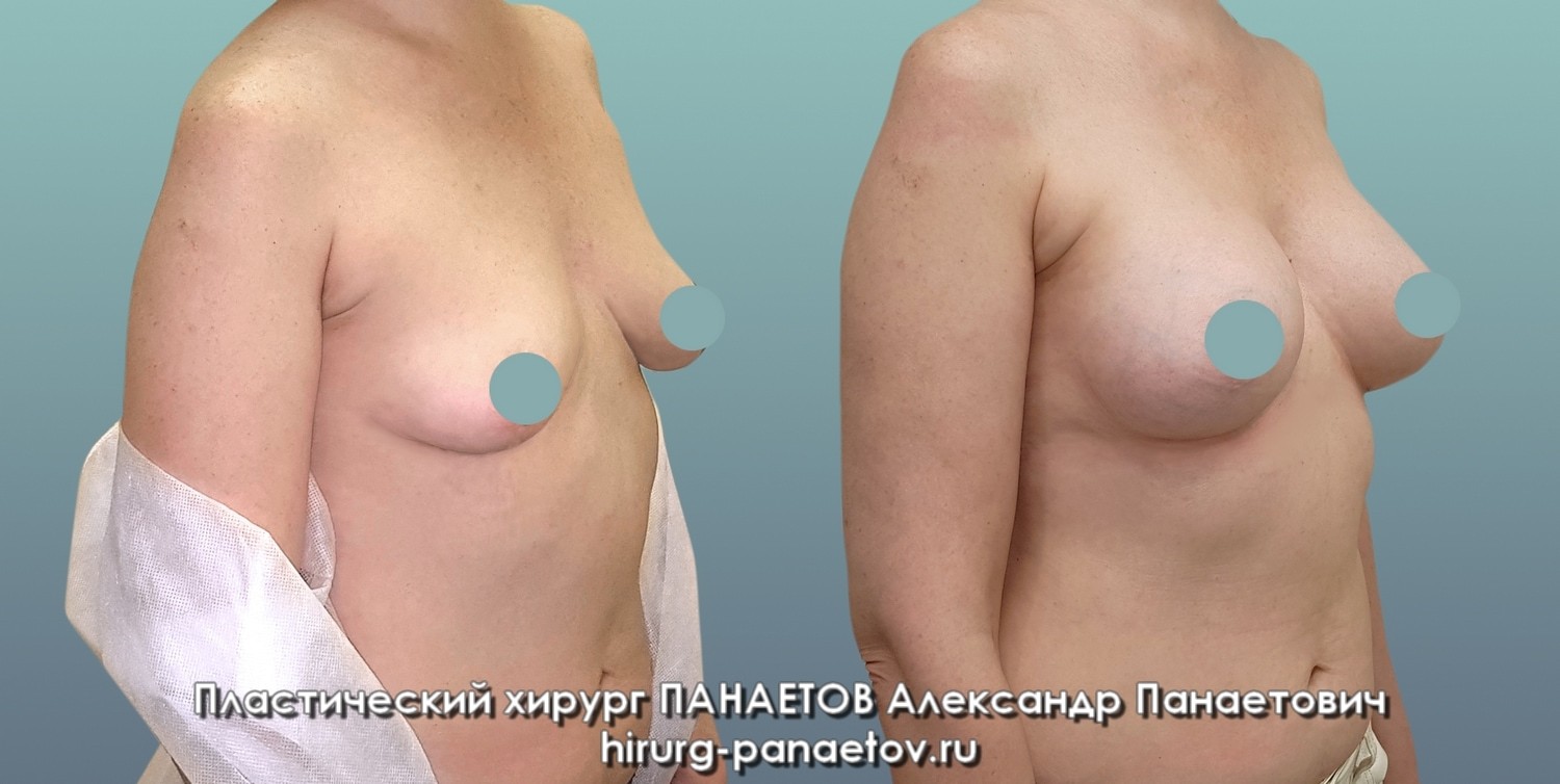 PAN-26-june-GR-lev-3