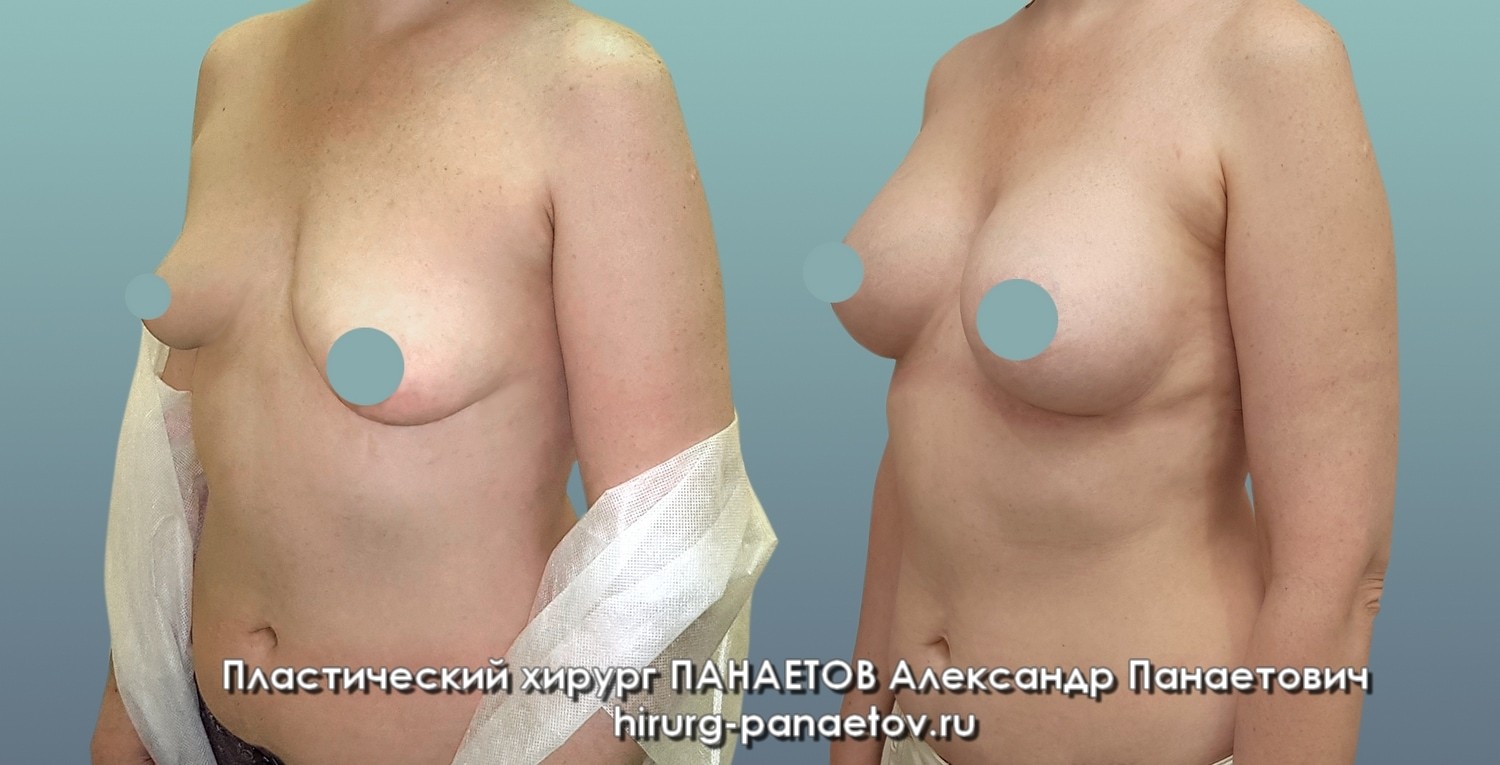 PAN-26-june-GR-prav-2