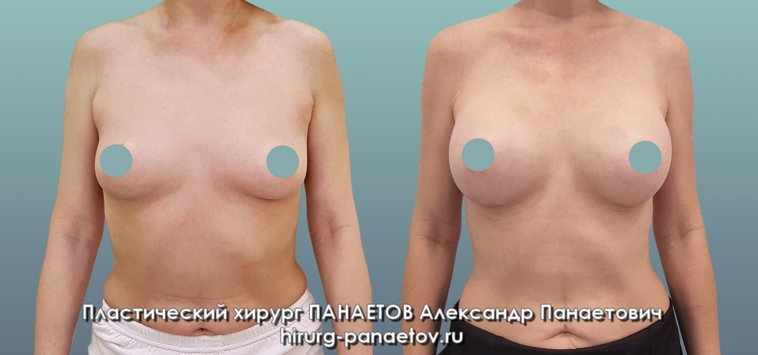 PAN-28-june-GR-fas-1