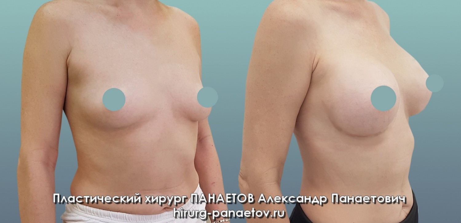 PAN-28-june-GR-prav-1