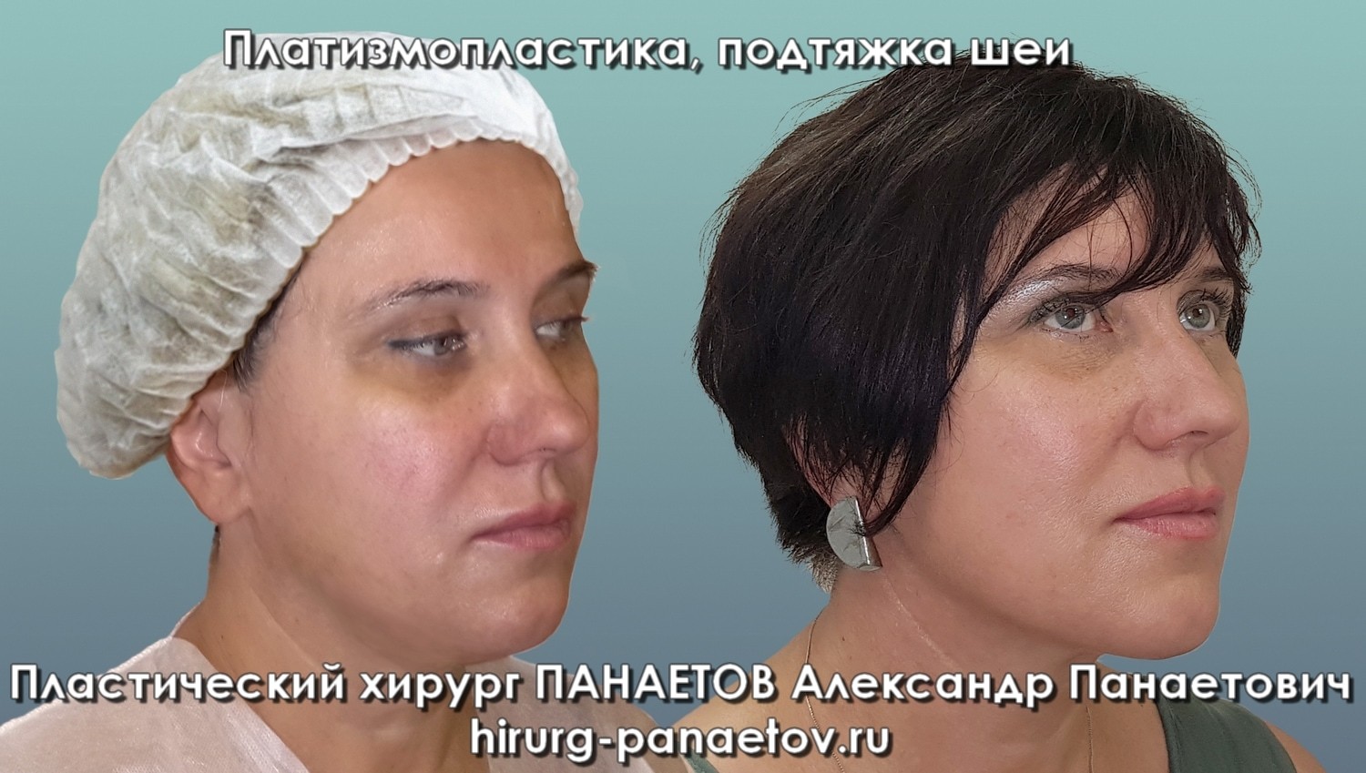 PAN-28-june-PODBOR-1-job1