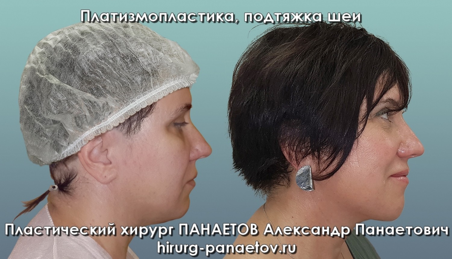 PAN-28-june-PODBOR-2-job1