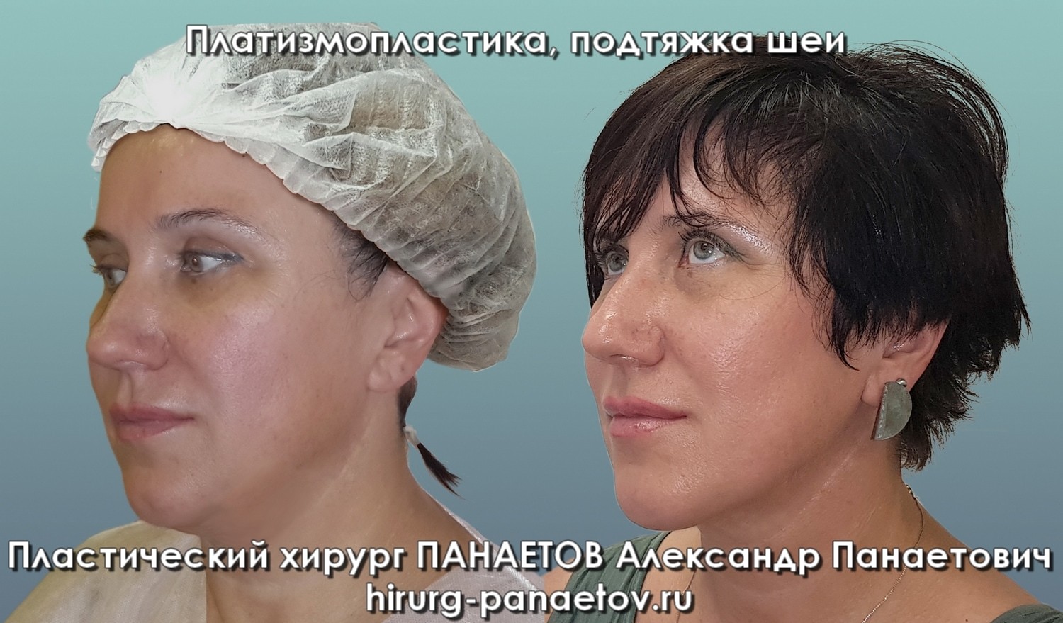 PAN-28-june-PODBOR-3-job1