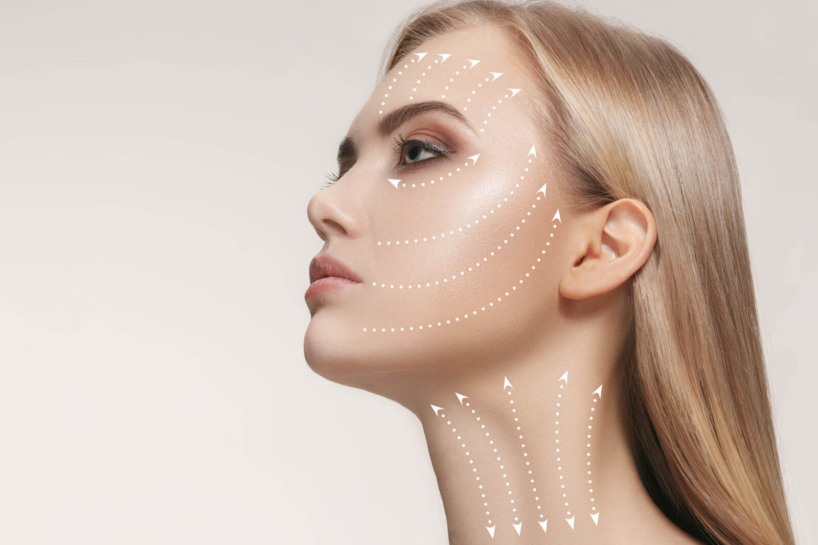 Нитевой лифтинг